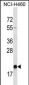 TMED2 Antibody (N-term)